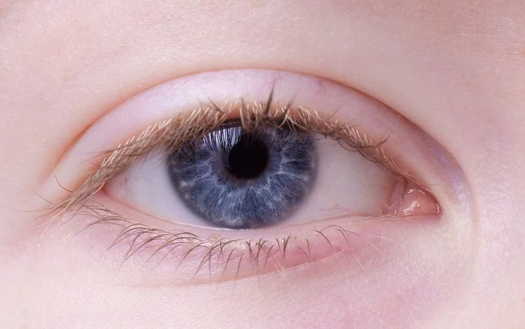 Kuracja oczu – jaki typ terapii wybrać?
